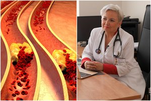 Kardiologė ragina suklusti: simptomų nejusti, o gresia infarktas