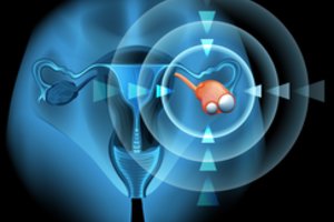 Kiaušidžių vėžys: kokios genetikos mokslo galimybės ligą diagnozuoti anksti?