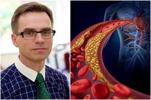 Profesorius įspėjo dėl ligos, kuri savo juodą darbą atlieka tyliai: atskleidė, kaip tausoti širdį