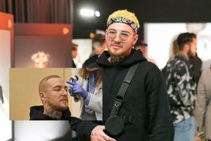 Naglis Bierancas ryžosi plaukų transplantacijai: „Pradėjau plikti 19-os“