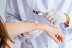 Kada dėl apgamo kreiptis į medikus? Svarbu ir odos darinių skaičius, ir jūsų amžius