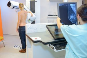 Prašo suklusti moteris: apsisaugoti nuo dažno vėžio galima nemokamai