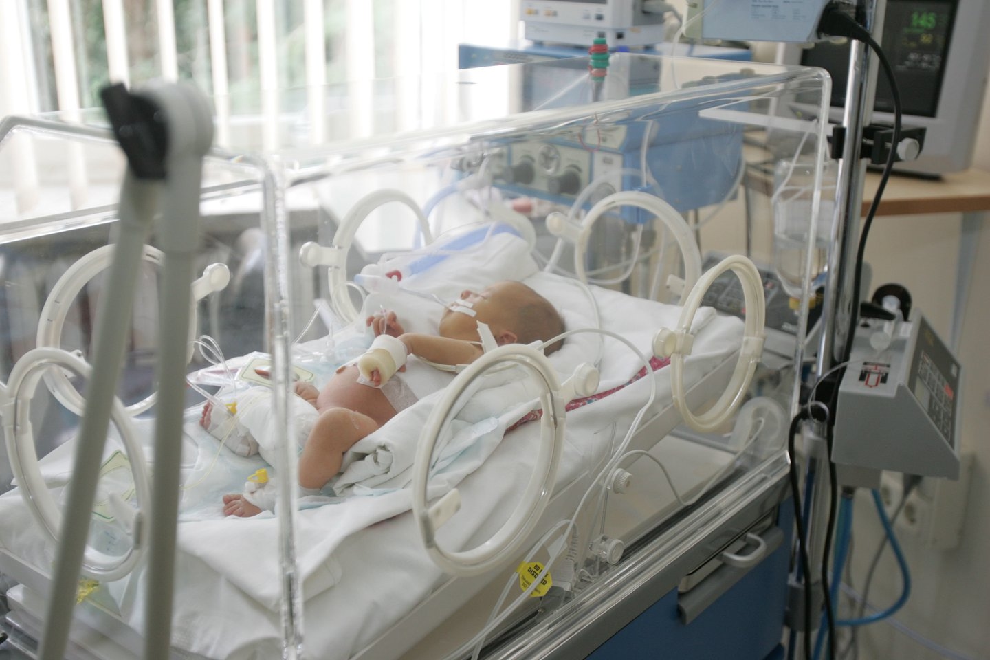 Ukrainoje neišnešiotiems kūdikiams trūksta inkubatorių.<br>A.Barzdžiaus nuotr.