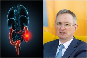 Medikai įspėja: daugelis klastingą vėžį pastebi per vėlai – įvardijo ligos ženklus
