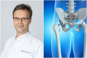Ortopedas paaiškino, kada prireikia klubo sąnario endoprotezavimo: nesigydant – pavojus širdžiai ir inkstams