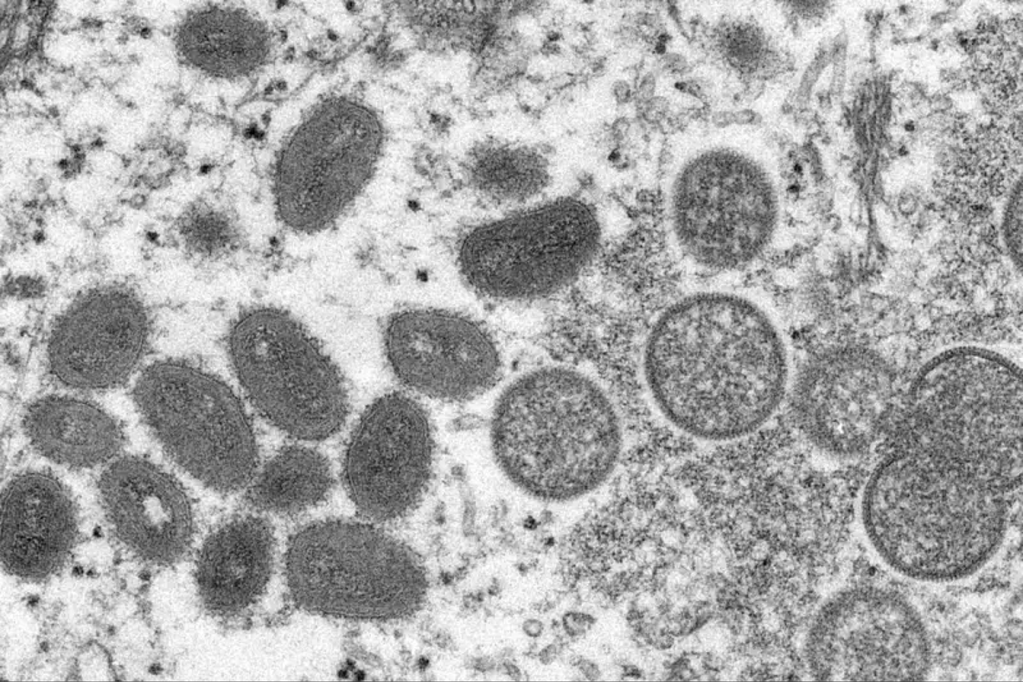 Beždžionių raupų viruso vaizdas, matomas elektroniniu mikroskopu.<br>CDC / C. S. Goldsmith nuotr.