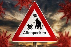 Vokietijoje susirgus beždžionių raupais – siūlymas tris savaites karantinuotis