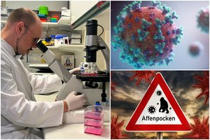 Ant naujos pandemijos slenksčio? Virusologas įvardijo esminius beždžionių raupų ir COVID-19 skirtumus