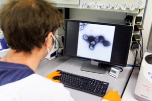 Skelbia, kad dalis lietuvių turi imunitetą prieš beždžionių raupus – svarbi gimimo data