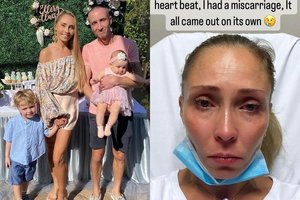 Šokėja Iveta Lukošiūtė patyrė persileidimą: kūdikio širdis nustojo plakti 11 savaitę