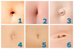 Kokia jūsų bambos forma? Iš jos net galime spėti, kiek žmogus gyvens