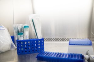 COVID-19 statistika: praėjusią parą – 446 užsikrėtimai, mirčių nefiksuota