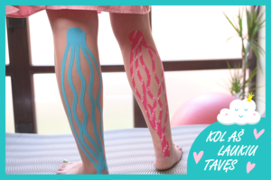 Metodas, kuris vasarą padės nėščiosioms tinstant kojoms: prilaiko pilvą, mažina veido brinkimą