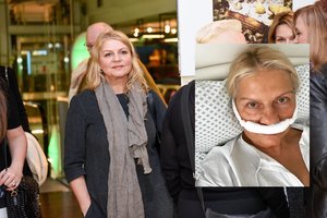 Violeta Baublienė ryžosi operacijai: „Pripratau, kad kartais negaliu skaityti teksto į mikrofoną“ 