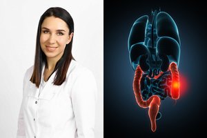 Žarnyno liga nejučia užklumpa net jaunus žmones: kokie signalai išduoda pavojų