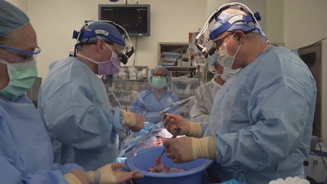Žengtas dar vienas žingsnis gyvūnų organų transplantacijos link: žmonėms persodintos kiaulių širdys