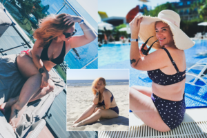 Tobulai įdegti negalinti Donata Virbilaitė: „Vis bandau rasti būdų“