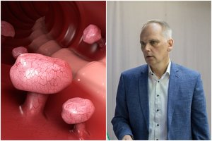 Nereikia keisti nei įpročių, nei mitybos: paprastas testas apsaugo nuo klastingo vėžio