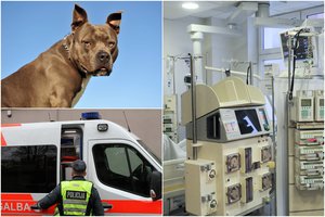 Alytuje – kraupus pitbulio išpuolis prieš 9 metų mergaitę: „Šuo vaikui beveik nukando koją“