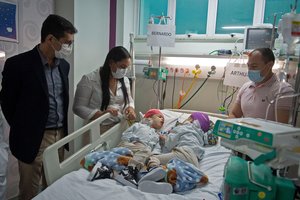 Įspūdinga operacija: galvomis suaugę dvyniai buvo atskirti pasitelkus virtualiąją realybę