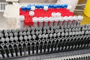 Sekoskaitos tyrimus Nacionalinė laboratorija ketina pradėti rugsėjį