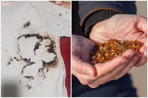 Gintarų rinkimas baigėsi ligoninėje: Tomo sūnus jį supainiojo su itin pavojinga medžiaga