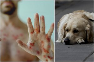 To dar nebuvo: užregistravus pirmą beždžionių raupų perdavimo iš žmogaus šuniui atvejį – PSO perspėjimas