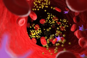 Natūralūs būdai, kurie padės sumažinti cholesterolio kiekį kraujyje