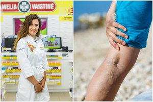 Vaistininkė ragina suklusti: kraujotakos sutrikimą išduoda kojos – šiomis dienomis vienas simptomas itin dažnas