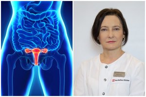 Nereguliarios, skausmingos ir gausios mėnesinės – apie kokias sveikatos problemas tai praneša?