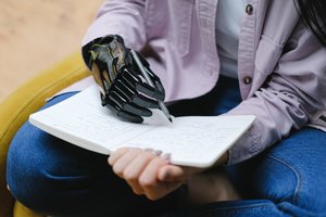 Gera žinia: ligonių kasos nuo šiol kompensuos ypač brangius protezus