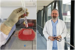 Vilniaus ligoninėje – perversmą medicinoje sukėlusi naujovė: genetiškai pakeistos imuninės ląstelės kovoja su vėžiu