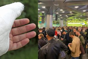 Paskelbus mobilizaciją, internete rusai pradėjo ieškoti patarimų, kaip susilaužyti ranką