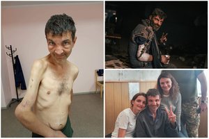 Iš okupantų pragaro išlaisvintą Ukrainos gynėją apžiūrėję medikai: rankos kaului trūksta 4 centimetrų