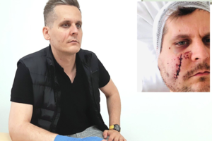 Baili tyla prišaukė baisią nelaimę: po žiauraus užpuolimo vos gyvas likęs klaipėdietis turi rimtų klausimų