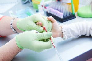 Gydytoja paneigė mitus: kada badavimas prieš kraujo tyrimus nėra būtinas