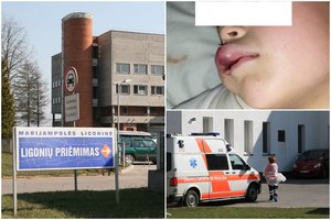 Net medikai pakraupo pamatę, kaip sužalotą vaiką kolegos išleido namo: šešiametei galėjo grėsti mirtinas pavojus