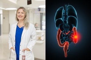 Gydytoja patarė, kaip nepražiopsoti dažno vėžio: ligos išsivystymą lemia kelios klaidos