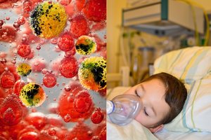 Klastingasis meningokokas gali būti painiojamas su gripu: įvardijo svarbiausius požymius