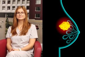 Gydytoja įvardijo, kokią krūtų savybę turinčios moterys turėtų būti itin budrios dėl vėžio