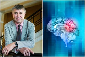 Išvardijo, kokiems žmonėms insulto grėsmė didžiausia: profesorius ragina įsiminti šiuos požymius