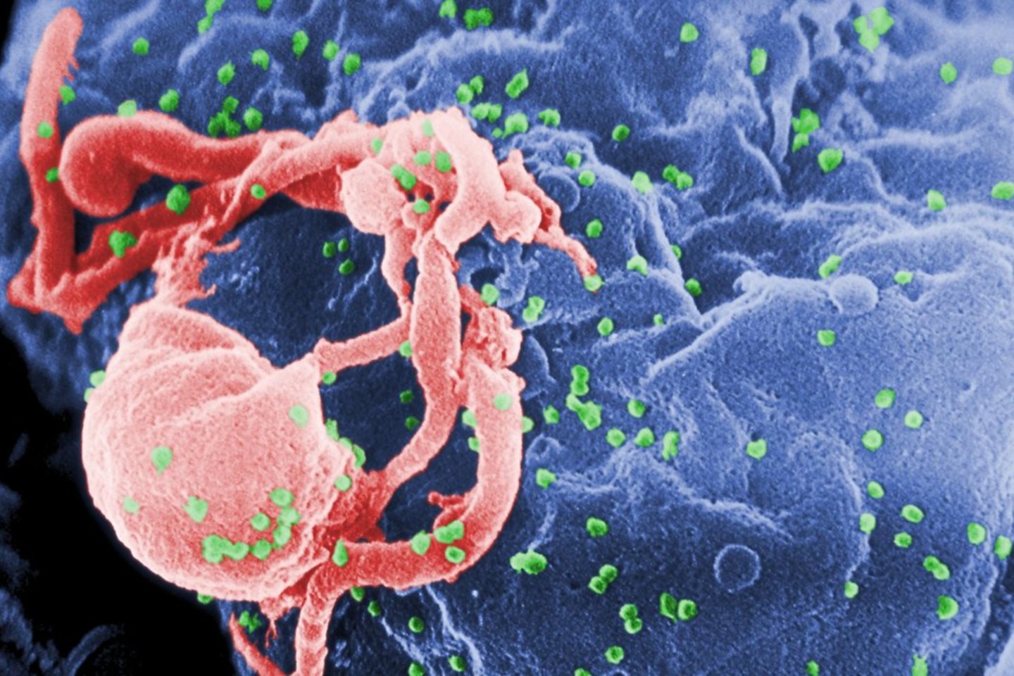  Elektroninė mikrografija, kurioje ŽIV-1 (žalia spalva) išsiskiria iš auginamo limfocito.<br> Wikimedia commons