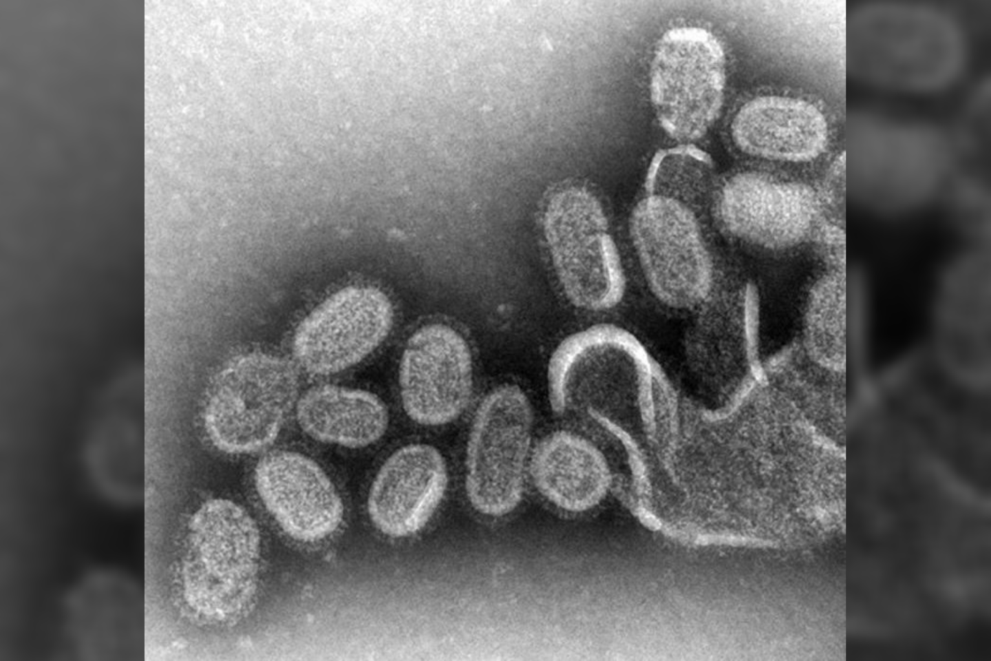  Gripu užsikrečia labai daug žmonių, todėl jis yra vienas pagrindinių virusų žudikų visame pasaulyje.<br> Wikimedia commons