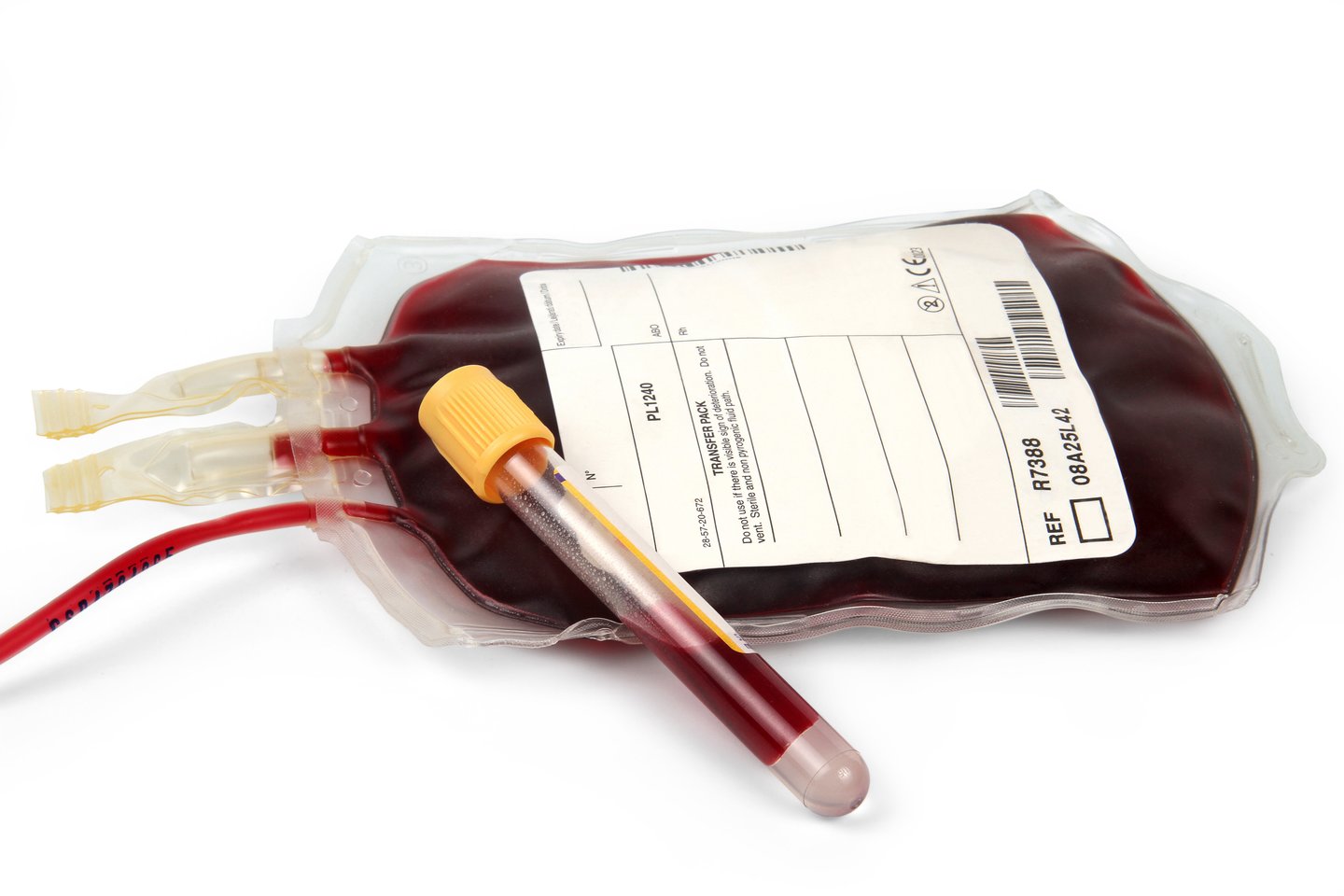  Karo metu Ukraina niekada negavo donorų kraujo iš užsienio partnerių.<br> 123rf nuotr.
