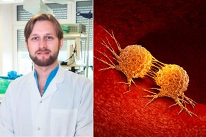 Gydytojas ragina nebijoti vėžio diagnozės: netiesa, kad būtinai reikės operacijos, spindulių, nuslinks visi plaukai