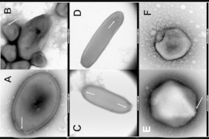 Atgaivino amžinajame Sibiro įšale snaudusius virusus. Ar jie gali užkrėsti žmones?