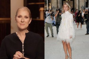 Celine Dion prisipažino serganti nepagydoma liga: ji diagnozuojama vos vienam iš milijono