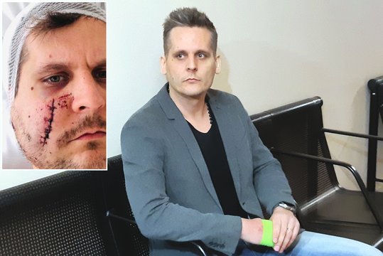 Kraupiai sužalotam mokytojui iš Klaipėdos – šalta išvada: vos nenužudė, bet kaltų nėra