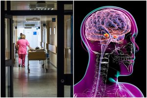 Smegenis naikinančia liga sergantys lietuviai bijo likti be gydymo: medikams jau svyra rankos