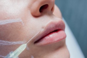 Grožio industrijoje – paradoksas: infliacijos fone lūpas putlina už žemesnę kainą